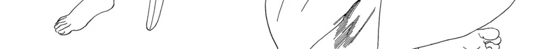 Akebi