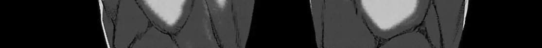 DEAD Tube Chapter 68 page 4 - 