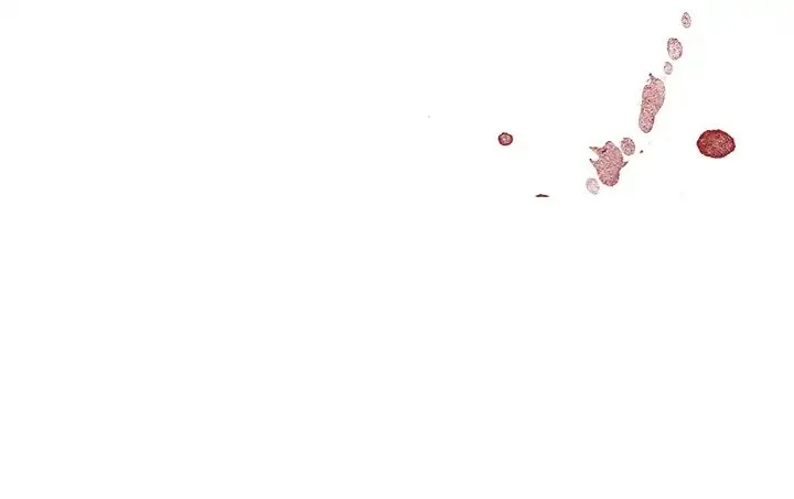 Happening Chapter 5 page 116 - 