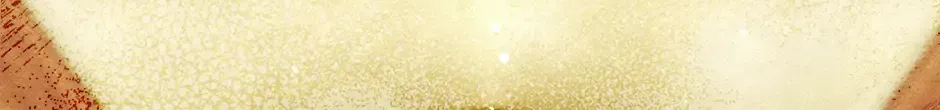 I Am Living an Unmarried Life With a Terminally Ill Lover Chapter 32 page 23 - 