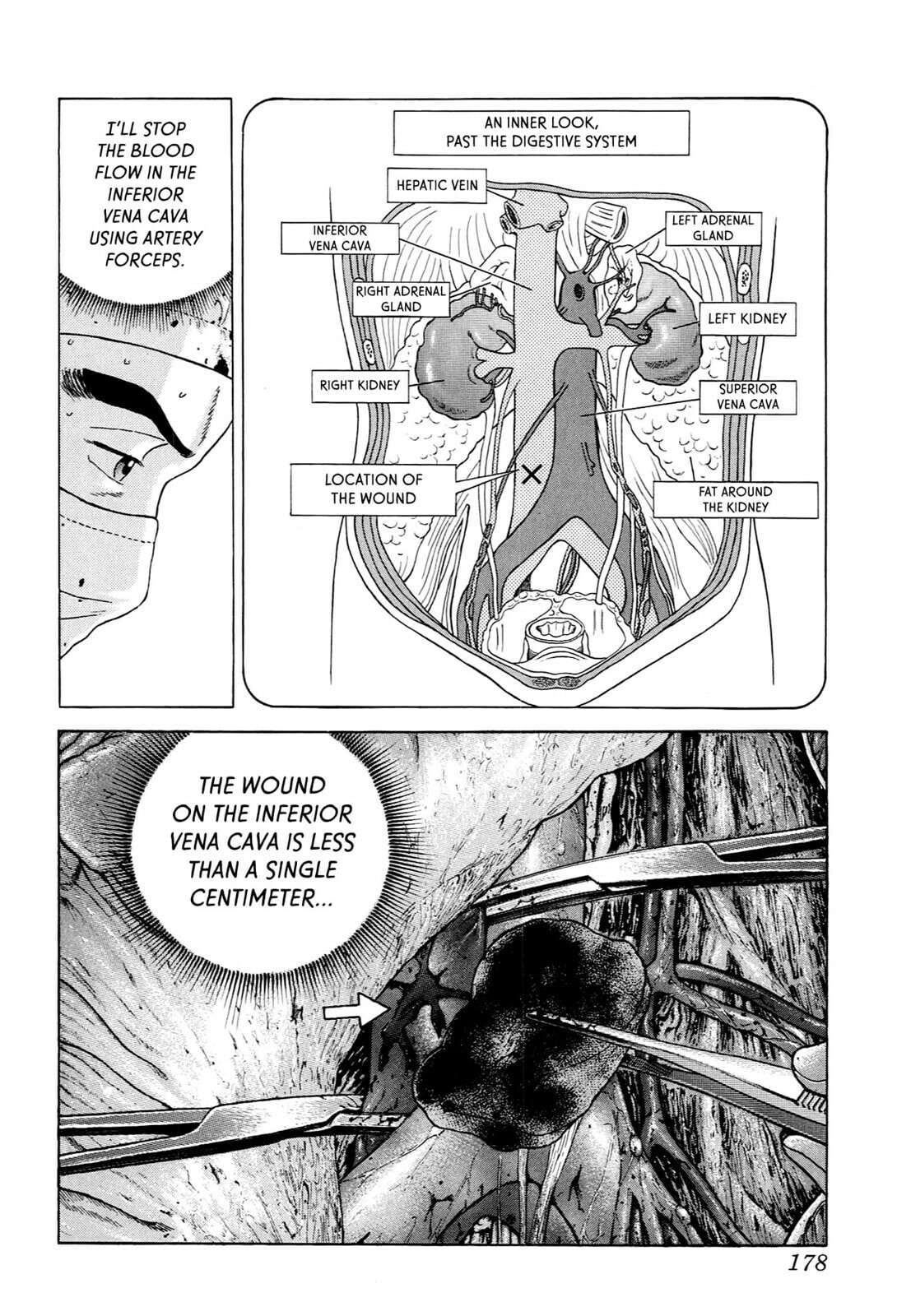 JIN Chapter 70 page 17 - 