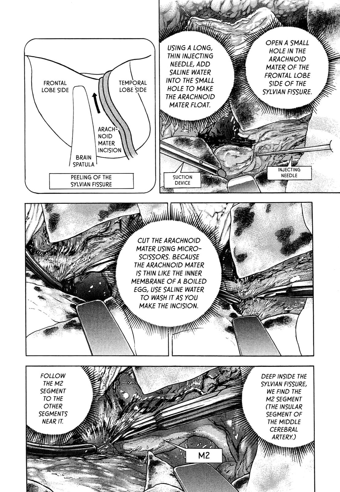 JIN Chapter 89 page 5 - 