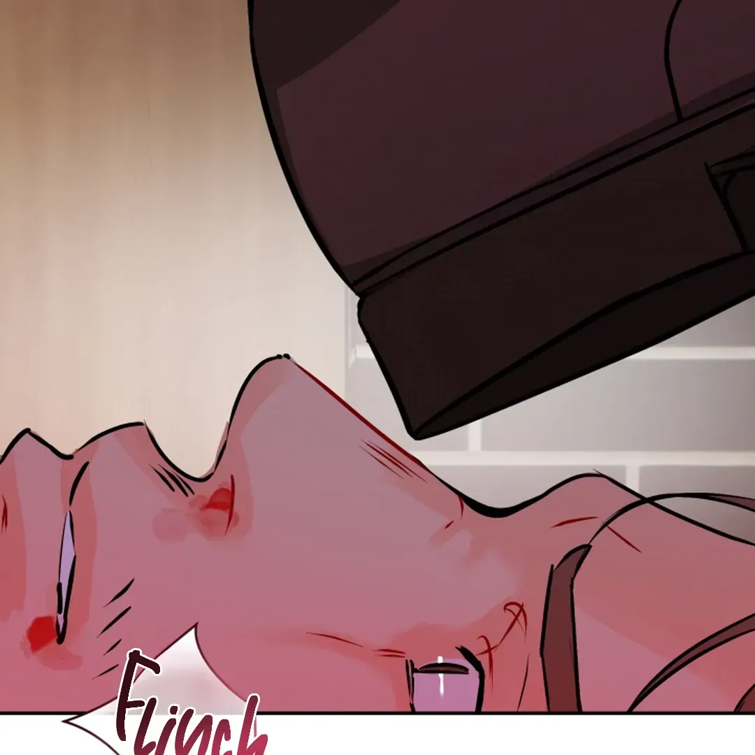 Prostate Capture Report Chapter 21 page 152 - 