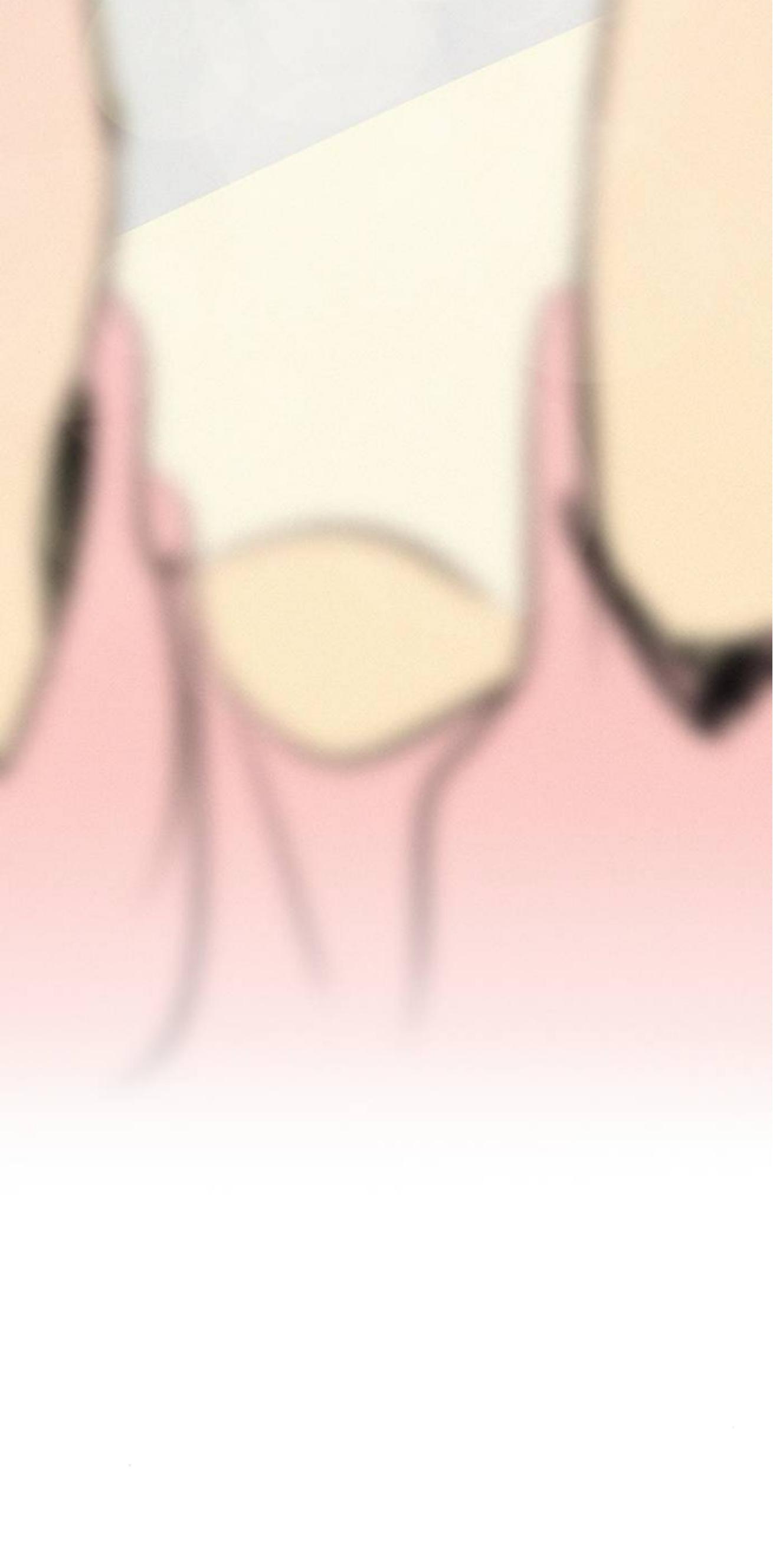 Why Don